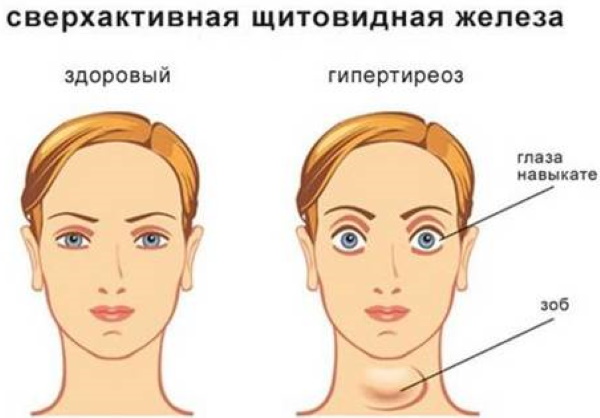 Laser Erbium trong thẩm mỹ. Hình ảnh trước và sau, kết quả ứng dụng, đánh giá