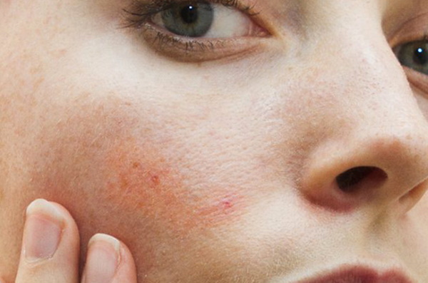 جل لتنظيف الوجه بالموجات فوق الصوتية. أيهما أفضل أو كيف يحل محل الاستعراضات