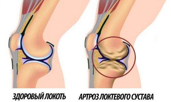Bài tập kéo xà cho các bạn nữ tập kéo lên