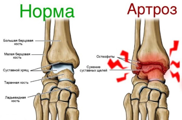 Latihan Pilates di rumah. Tutorial video untuk pemula