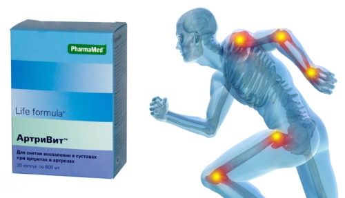 Vitaminas para articulações e ligamentos para atletas. Melhores nomes, preços
