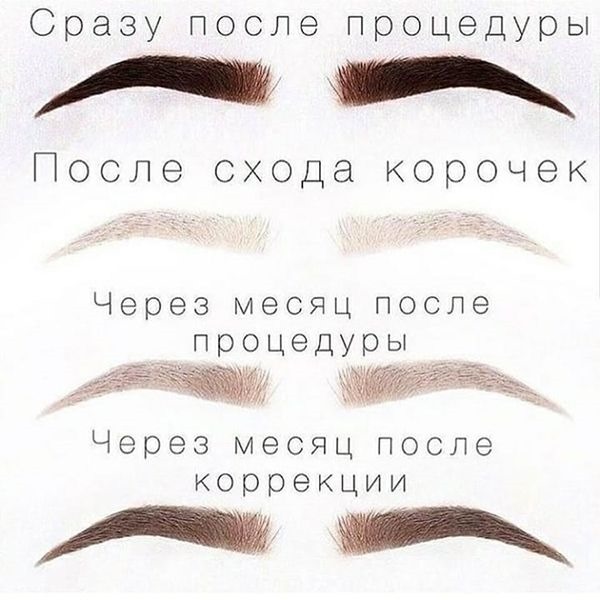 Како се праве обрве у праху. Техника прскања пикселом, фотографија након корекције, зарастање по дану, прегледи, нега