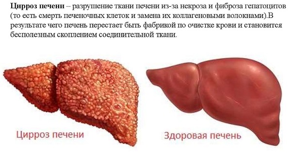 Tamoxifeno na musculação. Como tomar sem esteróides, sozinho, no curso. Instruções