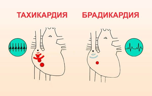Вежбе за мишић глутеус макимус за жену у теретани, код куће. Техника, фотографија
