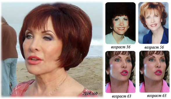 Facelift para o rosto. Exercícios eficazes, técnicas anti-inchaço, para apertar o oval, antes e depois das fotos