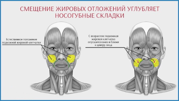 Гимнастика за назолабијалне наборе, вежбе, фластери. Како се отарасити код куће