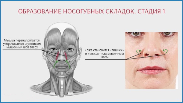 Гимнастика за назолабијалне наборе, вежбе, фластери. Како се отарасити код куће