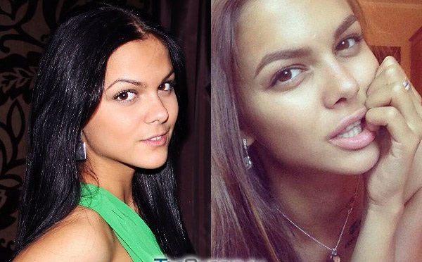 Victoria Odintsova. Hình ảnh trước và sau khi phẫu thuật thẩm mỹ, mặc áo tắm, thông số chiều cao, cân nặng, tuổi, hình thể, tiểu sử