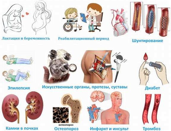 Вибрациона платформа за мршављење. Прегледи, користи и штета, како то учинити, контраиндикације