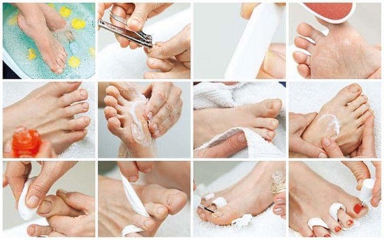 Pernas bonitas e saudáveis ​​em mulheres. Foto de como fazer pernas finas, fortes e suaves