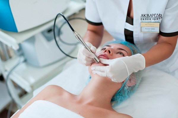 Tái tạo bề mặt kim cương (làm sạch) khuôn mặt. Nhận xét, hình ảnh trước và sau khi bóc