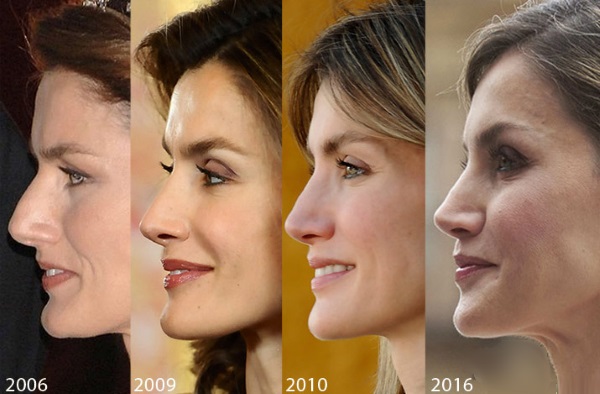 Nữ hoàng Letizia của Tây Ban Nha. Hình ảnh trước và sau khi phẫu thuật thẩm mỹ, chiều cao và cân nặng, các thông số