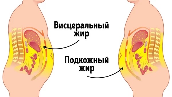 Mỡ bụng dưới da. Làm thế nào để thoát khỏi. Cách tính tỷ lệ phần trăm, thuốc uống, chế độ ăn uống, tiêm thuốc, bài tập