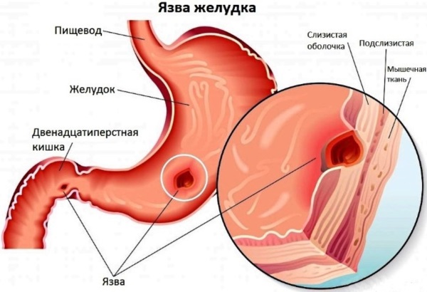 Порзиола за мршављење. Прегледи, упутства за употребу, аналоги, цена