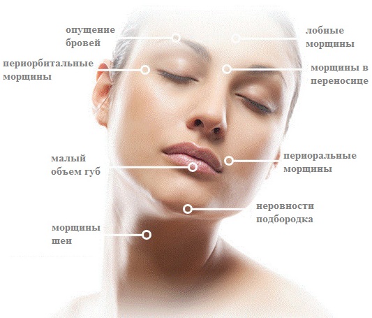 Botulax (Botulax): đánh giá của các chuyên gia thẩm mỹ, giá cả, hướng dẫn sử dụng