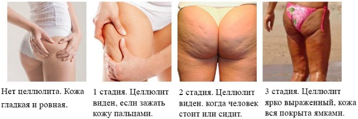 Крема од наранџе за целулит Фитнесс Боди Флоресан (Флоресан). Прегледи, цена