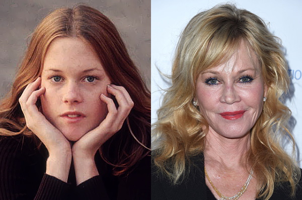 Melanie Griffith. Hình ảnh thời trẻ và bây giờ, trước và sau khi phẫu thuật thẩm mỹ, tiểu sử