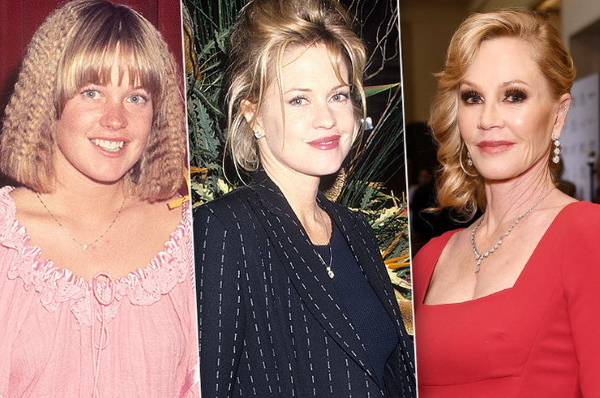 Melanie Griffith. Hình ảnh thời trẻ và bây giờ, trước và sau khi phẫu thuật thẩm mỹ, tiểu sử