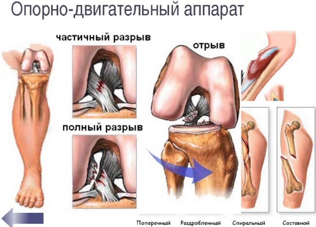Јоггинг. То је попут брзине, користи и штете, технике извршења