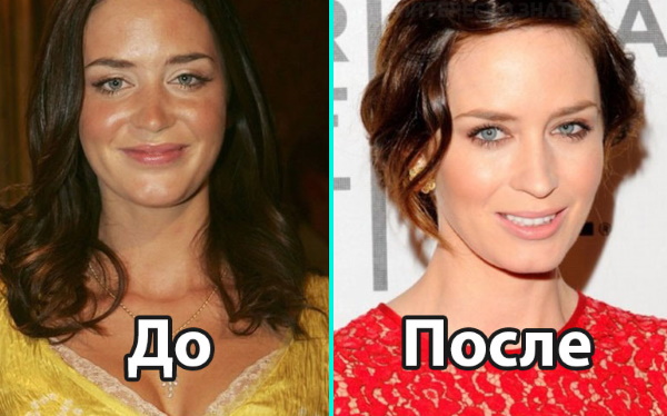 Emily Blunt. Hình ảnh nóng bỏng trong trang phục áo tắm, trước và sau phẫu thuật thẩm mỹ, tiểu sử, đời tư