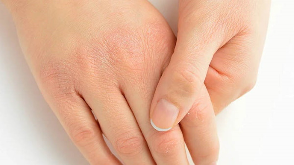 Manicure quente. O que é isso, a tecnologia de execução passo a passo. Vídeos, fotos, comentários