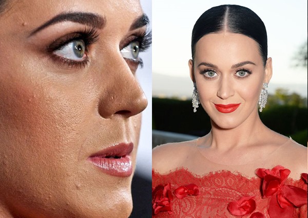 Katy Perry. ภาพถ่ายกำลังฮอตในชุดว่ายน้ำไม่ต้องแต่งหน้าก่อนและหลังการทำศัลยกรรมชีวประวัติชีวิตส่วนตัว