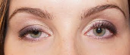 Botox sob os olhos. Antes e depois das fotos, efeitos, avaliações, consequências