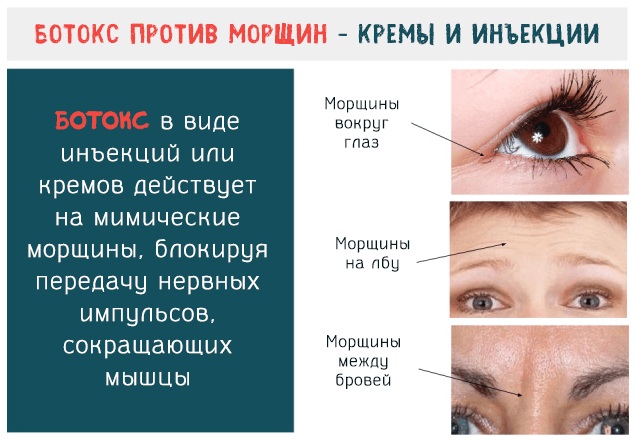 Botox tương tự cho da mặt do Nga sản xuất, Pháp, Hàn Quốc. Xeomin, Dysport, Relatox