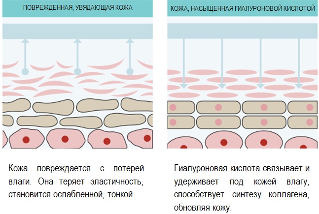 Botox tương tự cho da mặt do Nga sản xuất, Pháp, Hàn Quốc. Xeomin, Dysport, Relatox