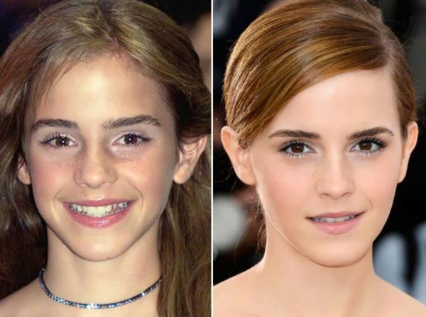 Emma Watson. Ảnh nóng, chân thực trong trang phục áo tắm, figure, tiểu sử, đời tư