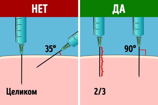 Никотин (никотинска киселина) у ињекцијама. Упутства, индикације за употребу, ток лечења