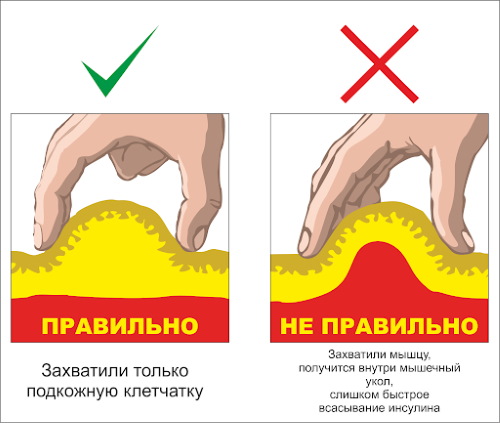 Никотин (никотинска киселина) у ињекцијама.Упутства, индикације за употребу, ток лечења