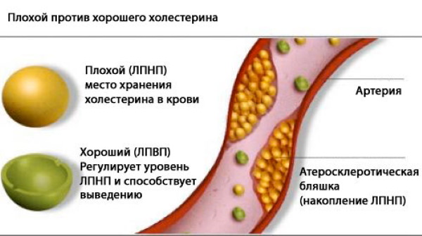 Никотин (никотинска киселина) у ињекцијама. Упутства, индикације за употребу, ток лечења