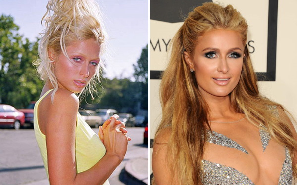 Paris Hilton. Hình ảnh nóng bỏng trong trang phục áo tắm, trước và sau khi phẫu thuật thẩm mỹ, hình thể, tiểu sử