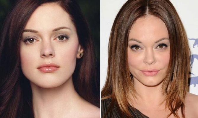 Rose McGowan. Foto bocor, sebelum dan selepas kemalangan, dicuri, biografi, kehidupan peribadi
