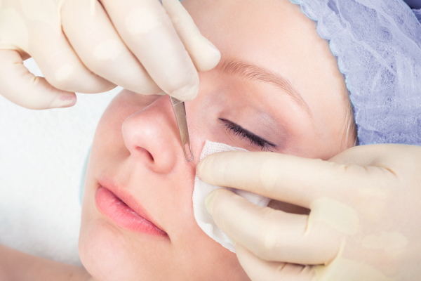 Limpando o rosto de uma adolescente por uma esteticista. Preço, comentários
