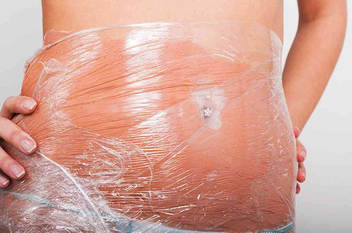 Penurunan berat badan yang melampau sebanyak 5-10 kg dalam seminggu di rumah