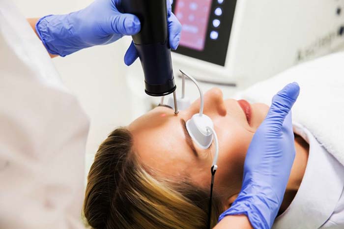 Xóa sẹo bằng laser trên mặt. Đánh giá, ảnh trước và sau, giá cả