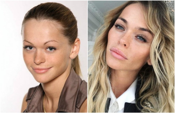 Diana Pozharskaya. Hình ảnh nóng bỏng trong trang phục áo tắm trước và sau khi phẫu thuật thẩm mỹ