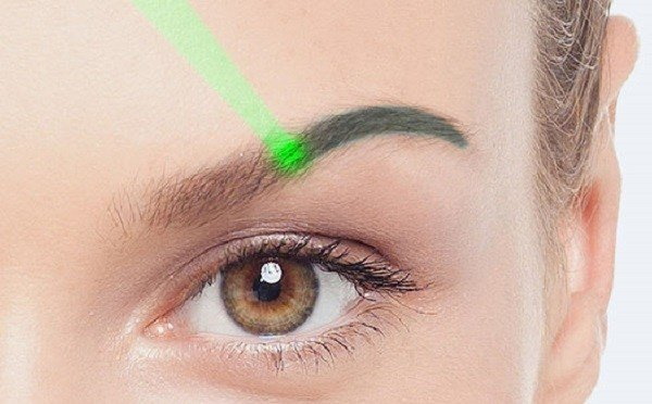 Penyingkiran laser dari solek kekal (tatu) alis, bibir, kelopak mata