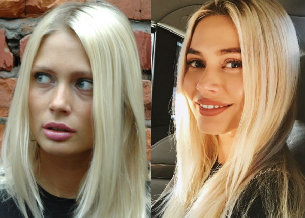 Natalia Rudova trước và sau khi phẫu thuật thẩm mỹ, ảnh nóng bỏng trong trang phục áo tắm, tiểu sử