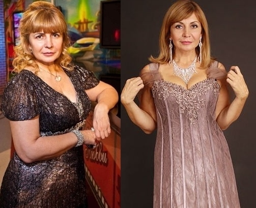Irina Agibalova. Gambar sebelum dan selepas pembedahan, penurunan berat badan