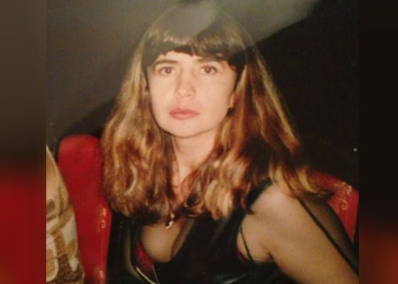 Irina Agibalova. Gambar sebelum dan selepas pembedahan, penurunan berat badan