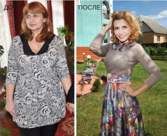Irina Agibalova. Gambar sebelum dan selepas pembedahan, penurunan berat badan