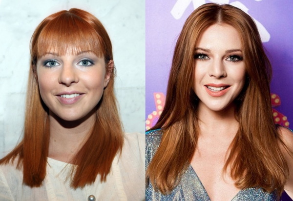 Natalia Podolskaya. Foto sebelum dan selepas rhinoplasty, biografi, kehidupan peribadi