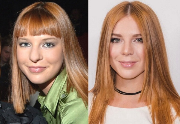 Natalia Podolskaya. Foto sebelum dan selepas rhinoplasty, biografi, kehidupan peribadi
